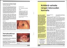 Kuparin Väri Ja Sen Merkitys Unissa