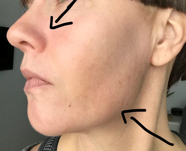 Unelmien Tulkinta: Miten Nappylat Eivät Vaan Näy